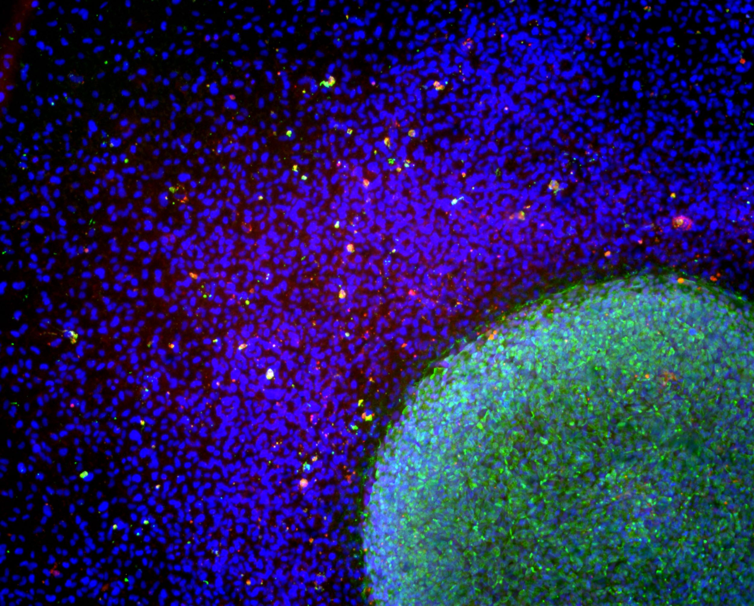 iBrain_Illustration2